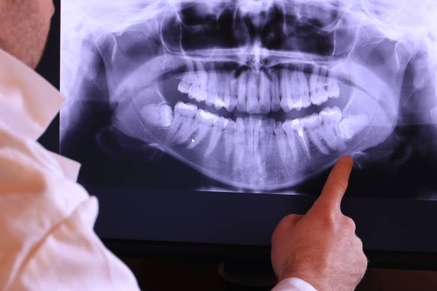 Best Emergency Dental Care for Abscessed Tooth in Grandville, MI