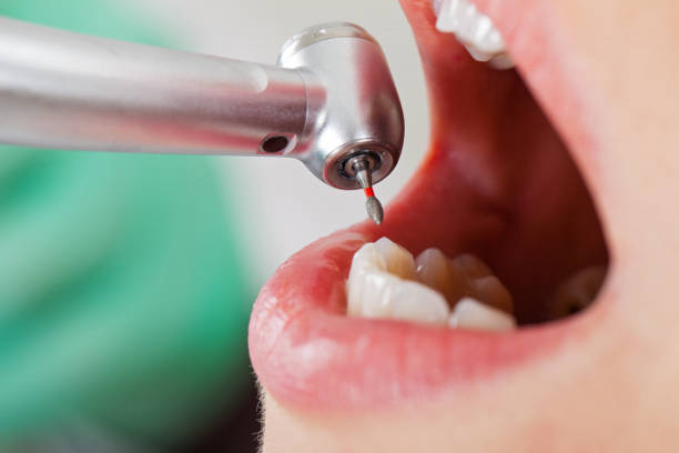 Best Mobile Emergency Dentist in Grandville, MI